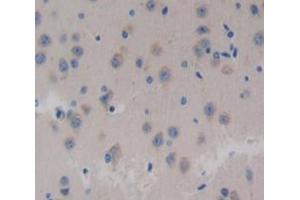 Used in DAB staining on fromalin fixed paraffin- embedded Kidney tissue (Neurocan antibody  (AA 960-1225))