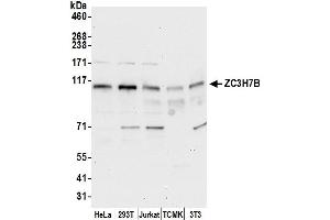 anti-Zinc Finger CCCH-Type Containing 7B (ZC3H7B) (AA 250-300) antibody