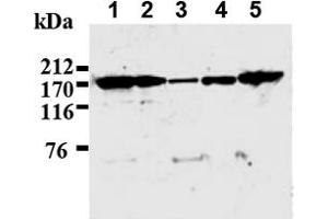Western Blotting (WB) image for anti-IQ Motif Containing GTPase Activating Protein 1 (IQGAP1) antibody (ABIN487492) (IQGAP1 antibody)