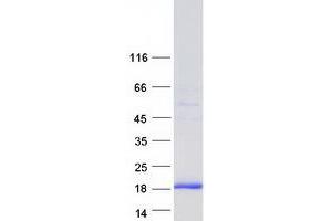 Validation with Western Blot