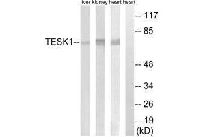 Western blot analysis of extracts from rat heart cells, rat kidney cells and rat liver cells, using TESK1 antibody. (TESK1 antibody)