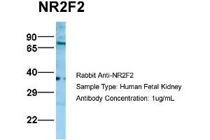 Host:  Rabbit  Target Name:  NR2F2  Sample Type:  Human Fetal Kidney  Antibody Dilution:  1. (NR2F2 antibody  (N-Term))