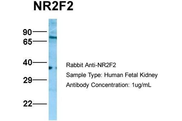 NR2F2 anticorps  (N-Term)
