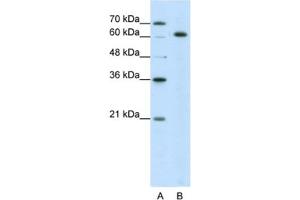 Western Blotting (WB) image for anti-Small Nuclear Ribonucleoprotein 70kDa (U1) (SNRNP70) antibody (ABIN2462077) (SNRNP70 antibody)