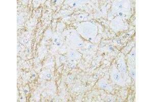 Immunohistochemistry of paraffin-embedded Mouse spinal cord using CNP Polyclonal Antibody at dilution of 1:100 (40x lens). (Cnpase antibody)
