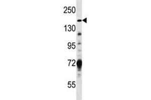 Hamartin antibody western blot analysis in MDA-MB231 lysate (TSC1 antibody  (AA 401-430))