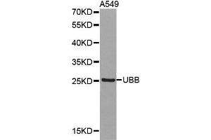 Western blot analysis of extracts of A549 cell lines, using UBB antibody. (Ubiquitin B antibody  (AA 1-76))