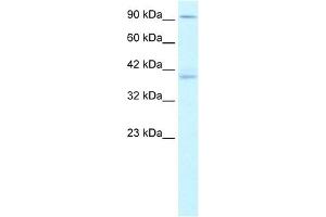 KIFC2 antibody used at 1. (KIFC2 antibody  (N-Term))