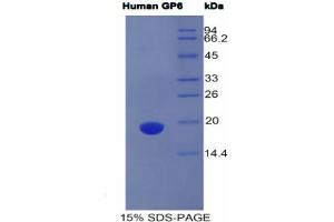 SDS-PAGE analysis of Human GP6 Protein. (GP6 Protein)