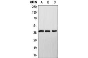 Western blot analysis of NDUFA9 expression in HeLa (A), SP2/0 (B), H9C2 (C) whole cell lysates. (NDUFA9 antibody  (Center))