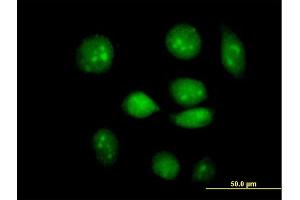 Immunofluorescence of purified MaxPab antibody to ARID3A on HeLa cell. (ARID3A antibody  (AA 1-593))