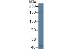 Western Blot; Sample: Mouse Kidney lysate; Primary Ab: 1µg/ml Rabbit Anti-Mouse ASK1 Antibody Second Ab: 0. (ASK1 antibody  (AA 693-933))