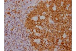 IHC image of ABIN7180562 diluted at 1:100 and staining in paraffin-embedded human tonsil tissue performed on a Leica BondTM system. (POU2AF1 antibody)