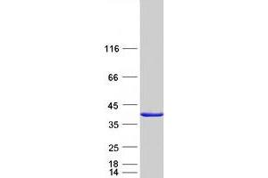 Validation with Western Blot (CDC34 Protein (Myc-DYKDDDDK Tag))