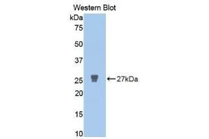 WB of Protein Standard: different control antibodies against Highly purified E. (MMP2 CLIA Kit)