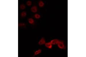 ABIN6266719 staining Hela by IF/ICC. (LMX1B antibody  (Internal Region))