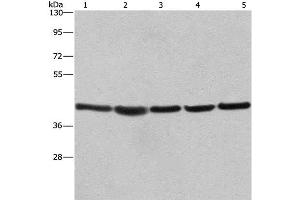 Western Blot analysis of A549, NIH/3T3 and 293T cell,Human hepatocellular carcinoma tissue and hela cell using RPSA Polyclonal Antibody at dilution of 1:433. (RPSA/Laminin Receptor antibody)