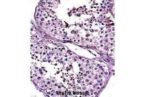 Immunohistochemistry (IHC) image for anti-Cancer/testis Antigen 2 (CTAG2) antibody (ABIN2997526) (CTAG2 antibody)