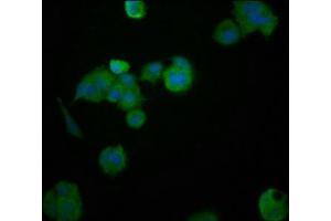 Immunofluorescence staining of MCF-7 cells with ABIN7155039 at 1:200, counter-stained with DAPI. (HEPACAM antibody  (AA 265-415))