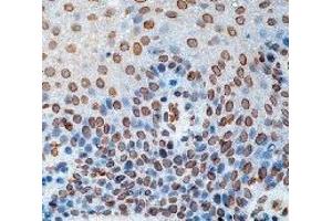 Formalin fixed paraffin embedded human tonsil stained with CDC25A antibody. (CDC25A antibody)