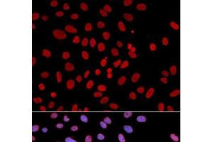 Immunofluorescence analysis of U2OS cells using PTPN6 Polyclonal Antibody (SHP1 antibody)