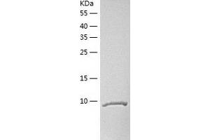Western Blotting (WB) image for Chemokine (C-C Motif) Ligand 27 (CCL27) (AA 26-120) protein (His tag) (ABIN7289611) (CCL27 Protein (AA 26-120) (His tag))
