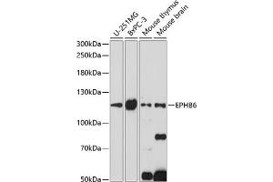 Western blot analysis of extracts of various cell lines, using EPHB6 antibody (ABIN7266973) at 1:1000 dilution. (EPH Receptor B6 antibody  (AA 615-729))