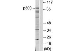 Western blot analysis of extracts from COLO205 cells, using p300/CBP Antibody. (KAT2B antibody  (AA 783-832))