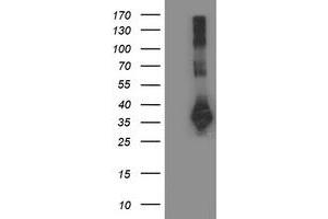 HEK293T cells were transfected with the pCMV6-ENTRY control (Left lane) or pCMV6-ENTRY SIRT5 (Right lane) cDNA for 48 hrs and lysed. (SIRT5 antibody)
