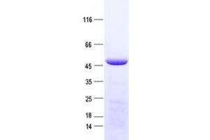Validation with Western Blot (IDH3G Protein (His tag))