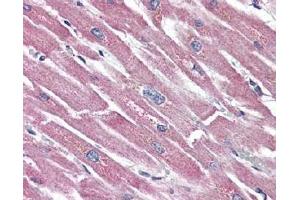 Heart, Human: Formalin-Fixed Paraffin-Embedded (FFPE) using Somatostatin Receptor 5 antibody. (SSTR5 antibody  (2nd Extracellular Domain))