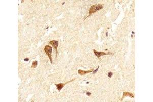 IHC analysis of FFPE human brain section using OTX2 antibody; Ab was diluted at 1:25. (OTX2 antibody  (C-Term))