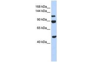 Image no. 1 for anti-N(alpha)-Acetyltransferase 16, NatA Auxiliary Subunit (NAA16) (AA 684-733) antibody (ABIN6743499) (NARG1L antibody  (AA 684-733))