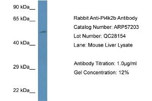 Western Blotting (WB) image for anti-Phosphatidylinositol 4-Kinase Type 2 beta (PI4K2B) (N-Term) antibody (ABIN785873) (PI4K2B antibody  (N-Term))