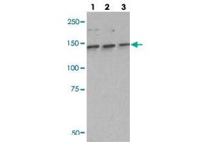 Western blot analysis of lane 1: A549 cell lysate, lane 2: H460 cell lysate and lane 3: H1703 cell lysate using IARS polyclonal antibody .