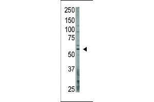 The anti-OASIS C-term Antibody (ABIN390167 and ABIN2840663) is used in Western blot to detect OASIS in  lysate. (CREB3L1 antibody  (C-Term))