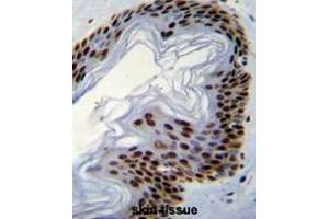 Formalin fixed, paraffin embedded human skin tissue stained with IFI35 Antibody (N-term) followed by peroxidase conjugation of the secondary antibody and DAB staining. (IFI35 antibody  (N-Term))