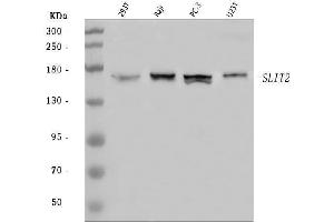 Western blot analysis of SLIT2 using anti-SLIT2 antibody (ABIN7602678).