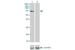 Western Blotting (WB) image for anti-ATP-Binding Cassette, Sub-Family F (GCN20), Member 2 (ABCF2) (AA 1-110) antibody (ABIN599114) (ABCF2 antibody  (AA 1-110))