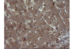 Image no. 1 for anti-Carboxypeptidase A2 (Pancreatic) (CPA2) antibody (ABIN1497598) (Carboxypeptidase A2 antibody)