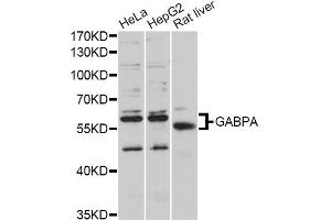 Western blot analysis of extracts of various cell lines, using GABPA antibody (ABIN5997766) at 1/1000 dilution. (GABPA antibody)