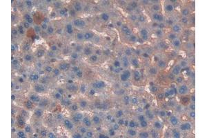 Used in DAB staining on fromalin fixed paraffin- embedded liver tissue (T-Kininogen 1 (KNT1) (AA 378-430) antibody)