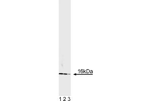 Western Blotting (WB) image for anti-Superoxide Dismutase 1, Soluble (SOD1) antibody (ABIN967513) (SOD1 antibody)