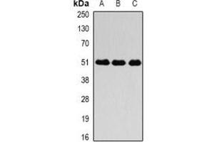 Western blot analysis of Fibrinogen gamma expression in SGC996 (A), mouse liver (B), mouse lung (C) whole cell lysates. (FGG antibody)