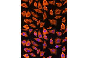 Immunofluorescence analysis of L929 cells using L Rabbit pAb (ABIN1680664, ABIN3018314, ABIN3018315 and ABIN6220434) at dilution of 1:100 (40x lens). (LASP1 antibody  (AA 130-205))