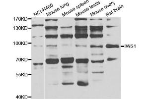 Western blot analysis of extracts of various cell lines, using IWS1 antibody. (IWS1 antibody)