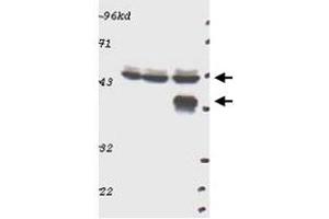 Western blot using MAPK3 polyclonal antibody  shows detection of MAPK3 in tissue lysates prepared from mouse brain (left), mouse kidney (center) and mouse intestine (right). (ERK1 antibody  (C-Term))