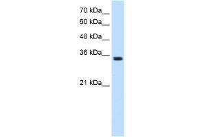 TRPM5 antibody used at 1. (TRPM5 antibody  (N-Term))