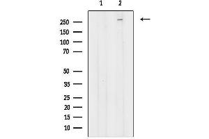 Western blot analysis of lysates from Hela cells(heat shock treatment), using NAV3 Antibody.
