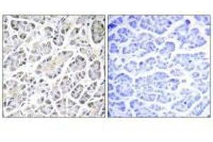 Immunohistochemistry analysis of paraffin-embedded human pancreas tissue using ATP5G3 antibody. (ATP5G3 antibody)